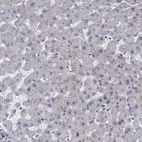 Anti-PKN2 Antibody