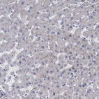 Immunohistochemical staining of human liver shows very weak cytoplasmic positivity in hepatocytes.