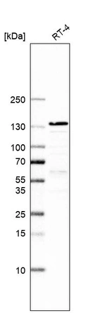 Western blot analysis in human cell line RT-4.