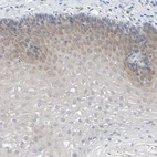 Anti-LRRC29 Antibody