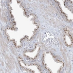 Anti-AFTPH Antibody