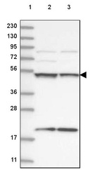 Lane 1: Marker [kDa] 230, 130, 95, 72, 56, 36, 28, 17, 11_br/_Lane 2: Human cell line RT-4_br/_Lane 3: Human cell line U-251 MG