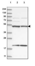 Lane 1: Marker [kDa] 230, 130, 95, 72, 56, 36, 28, 17, 11_br/_Lane 2: Human cell line RT-4_br/_Lane 3: Human cell line U-251 MG