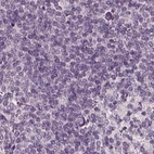 Immunohistochemical staining of human lymph node using Anti-OPTC antibody HPA034951.