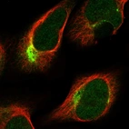 Immunofluorescent staining of human cell line U-2 OS shows localization to nucleoplasm & intermediate filaments.