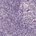 Immunohistochemical staining of human lymph node using Anti-OPTC antibody HPA034952.