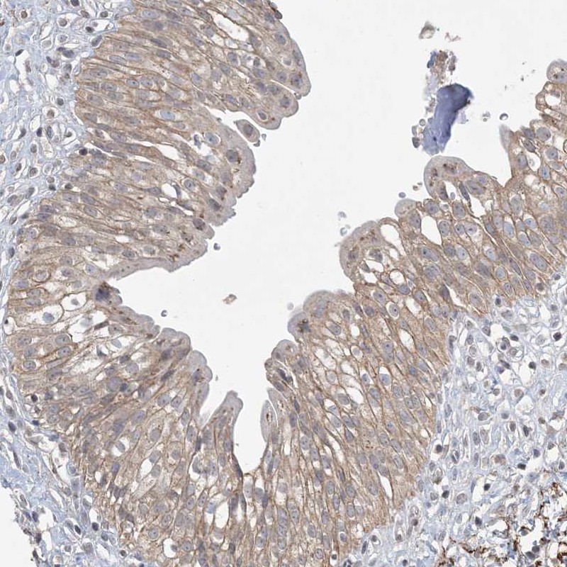 Anti-XRN1 Antibody