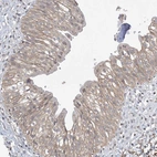 Anti-XRN1 Antibody