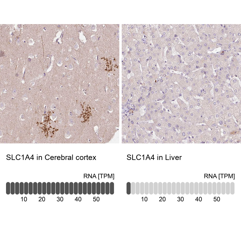 Anti-SLC1A4 Antibody