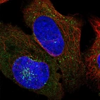 Immunofluorescent staining of human cell line U-2 OS shows localization to cytosol, the Golgi apparatus & vesicles.