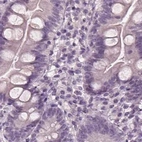 Immunohistochemical staining of human duodenum using Anti-OPTC antibody HPA034952.