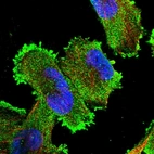 Immunofluorescent staining of human cell line U-251 MG shows localization to plasma membrane & cytosol.