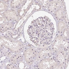 Immunohistochemical staining of human kidney shows no positivity in cells in glomeruli as expected.