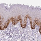 Immunohistochemical staining of human skin shows strong membranous positivity in a subset of squamous epithelial cells.