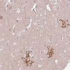 Immunohistochemical staining of human cerebral cortex shows strong membranous positivity in astrocytes.