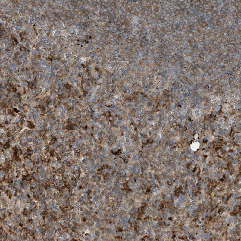 Anti-ABTB1 Antibody