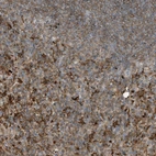 Anti-ABTB1 Antibody
