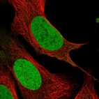 Immunofluorescent staining of human cell line U-2 OS shows localization to nucleoplasm.