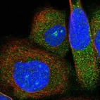 Immunofluorescent staining of human cell line A-431 shows localization to nucleoli & cytosol.