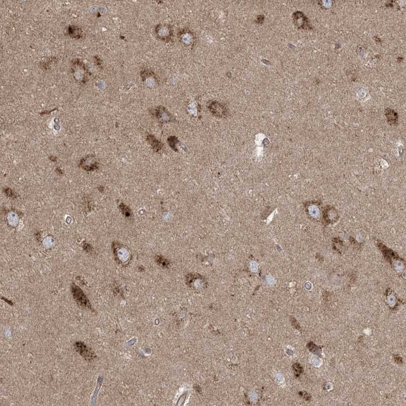 Anti-KLHL18 Antibody