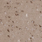 Anti-KLHL18 Antibody