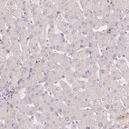 Immunohistochemical staining of human liver shows no positivity in hepatocytes as expected.