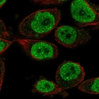 Immunofluorescent staining of human cell line PC-3 shows localization to nucleoplasm & nuclear bodies.
