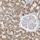 Immunohistochemical staining of human kidney shows strong positivity in cytoplasm in cells in tubules.