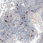 Anti-CHMP2B Antibody