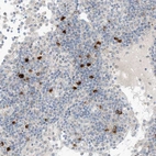 Anti-CHMP2B Antibody