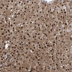 Anti-HIKESHI Antibody