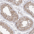 Anti-XKR3 Antibody