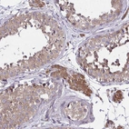 Immunohistochemical staining of human testis shows strong cytoplasmic positivity in Leydig cells.