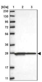 Lane 1: Marker [kDa] 230, 130, 95, 72, 56, 36, 28, 17, 11_br/_Lane 2: Human cell line RT-4_br/_Lane 3: Human cell line U-251MG sp