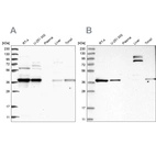 Western blot analysis using Anti-TBCC antibody HPA035074 (A) shows similar pattern to independent antibody HPA035073 (B).