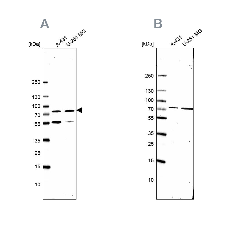 Anti-ATP6V1A Antibody