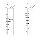 Anti-ATP6V1A Antibody