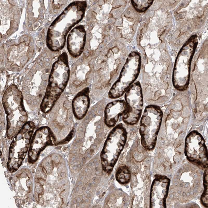 Anti-LRRC74A Antibody