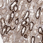 Anti-LRRC74A Antibody