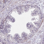 Immunohistochemical staining of human prostate shows no positivity in glandular cells as expected.