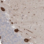 Anti-ZNF263 Antibody