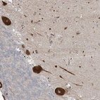 Anti-ZNF263 Antibody