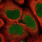 Immunofluorescent staining of human cell line U-2 OS shows localization to nucleus, cytosol & vesicles.
