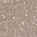 Anti-EPHX4 Antibody