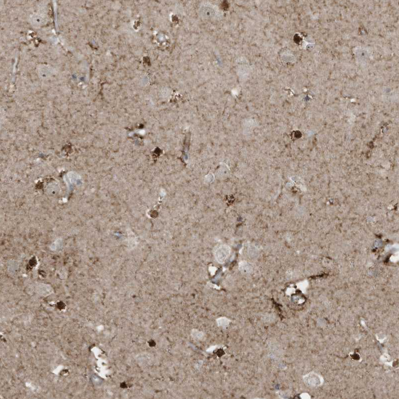 Anti-ZNF263 Antibody