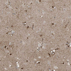 Anti-ZNF263 Antibody