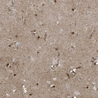 Anti-ZNF263 Antibody