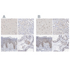 Anti-MPHOSPH10 Antibody