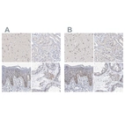 Anti-MPHOSPH10 Antibody