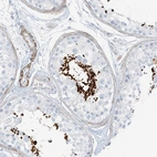 Anti-SMCP Antibody
